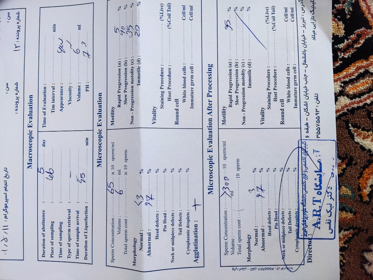 آزمایش اسپرم و آنالیز دی ان ای