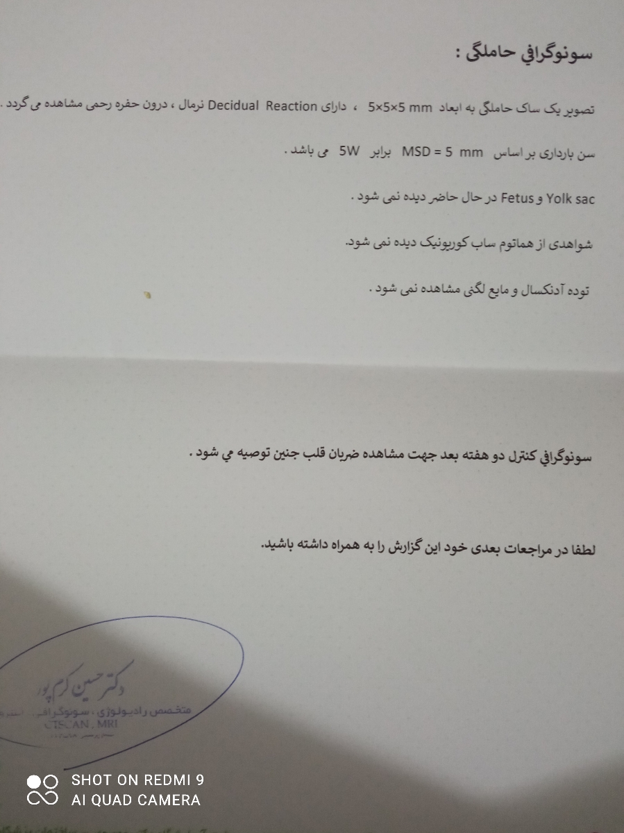 این سنوگرافی اول ک۸مرداد انجام دادم