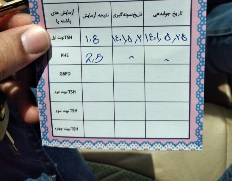 غربالگری تیروئید در نوزاد