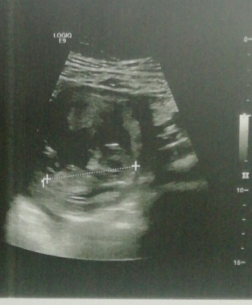 جنسیت از روی سنو ان تی جنسیت از روی سنو ان تی