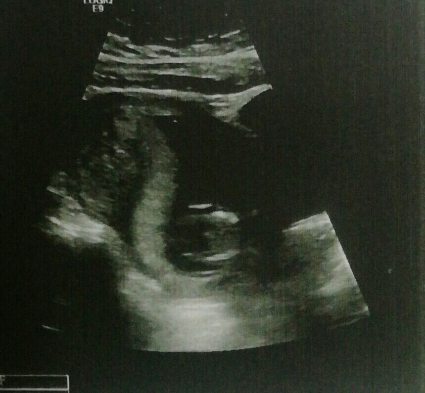 جنسیت از روی سنو ان تی جنسیت از روی سنو ان تی