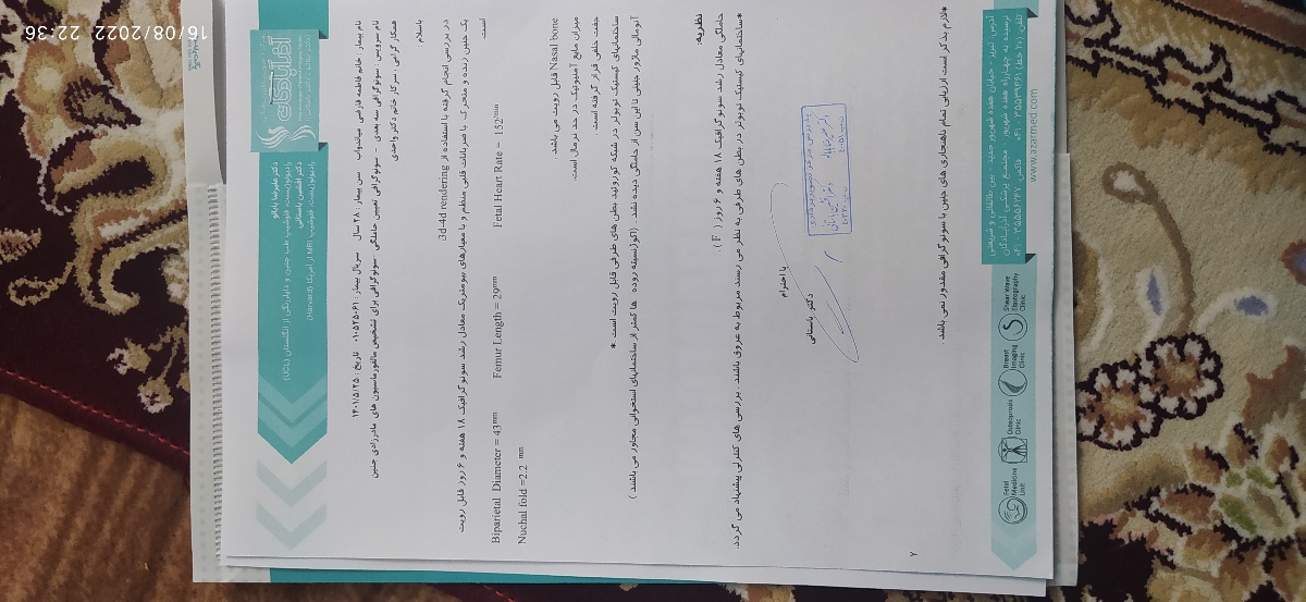 کیست شبکه کوروئید واکوژن روده گرید ۱ کیست شبکه کوروئید واکوژن روده گرید ۱