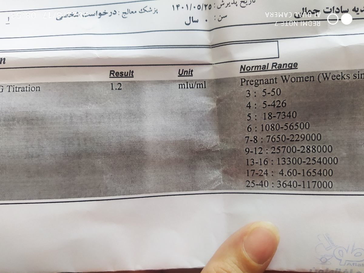 فرق آزمایش بتا معمولی با تیتر بتا فرق آزمایش بتا معمولی با تیتر بتا
