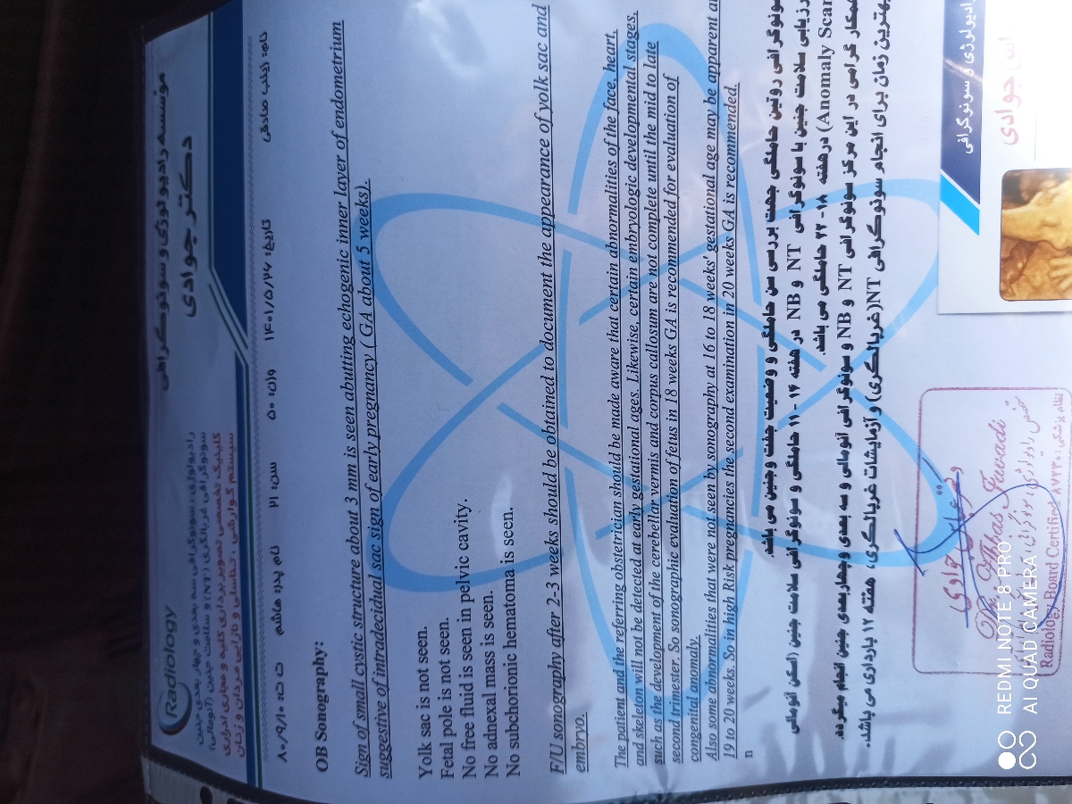 اینم عکس سونو اینم عکس سونو