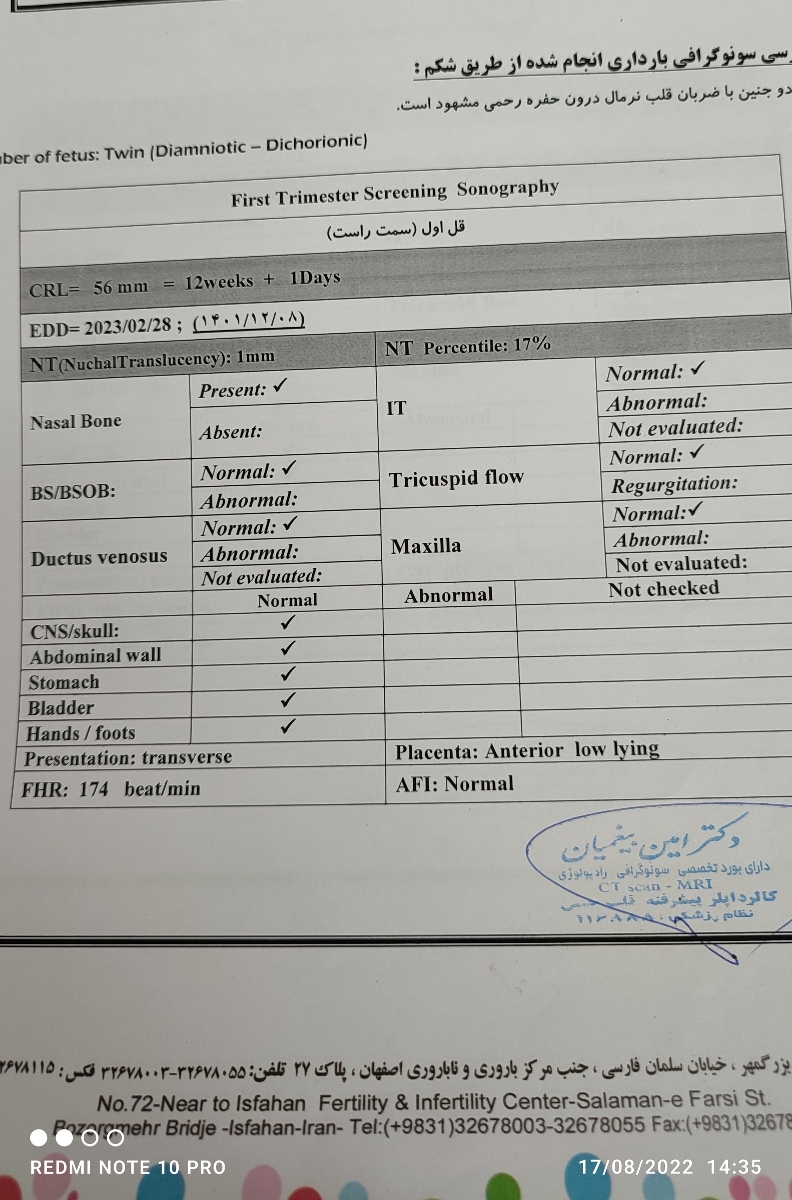 سونوگرافی دوازده هفته سونوگرافی دوازده هفته