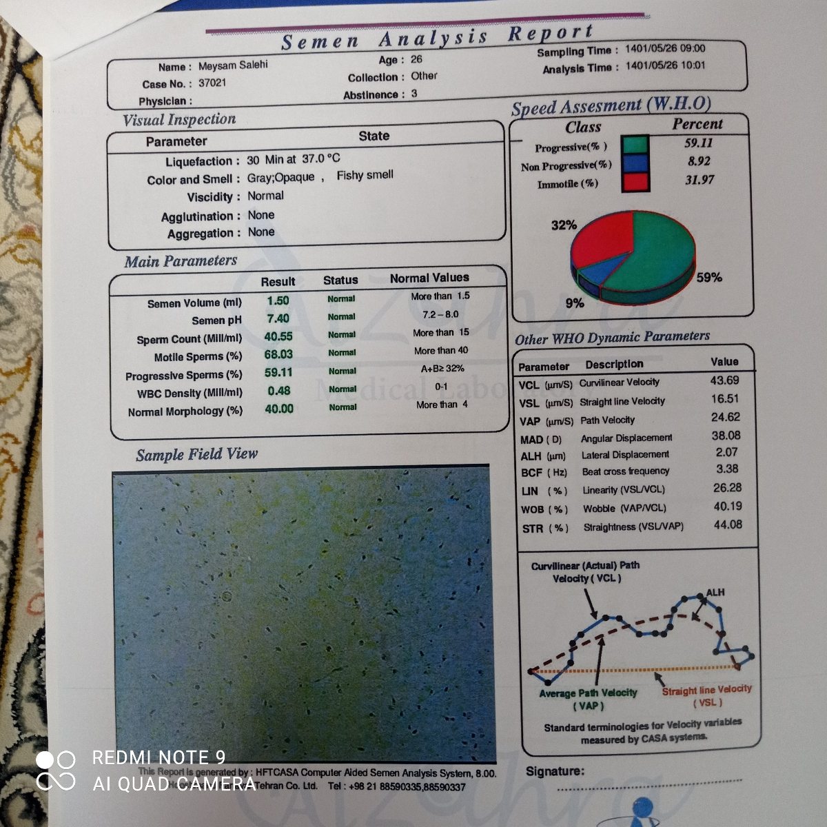 تفسیر آزمایش اسپرم