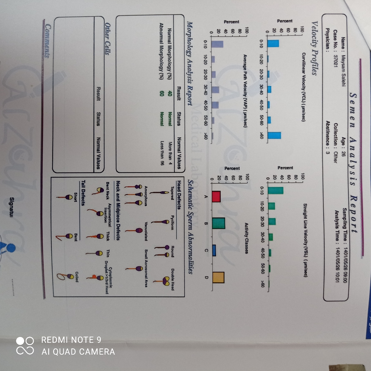 تفسیر آزمایش اسپرم