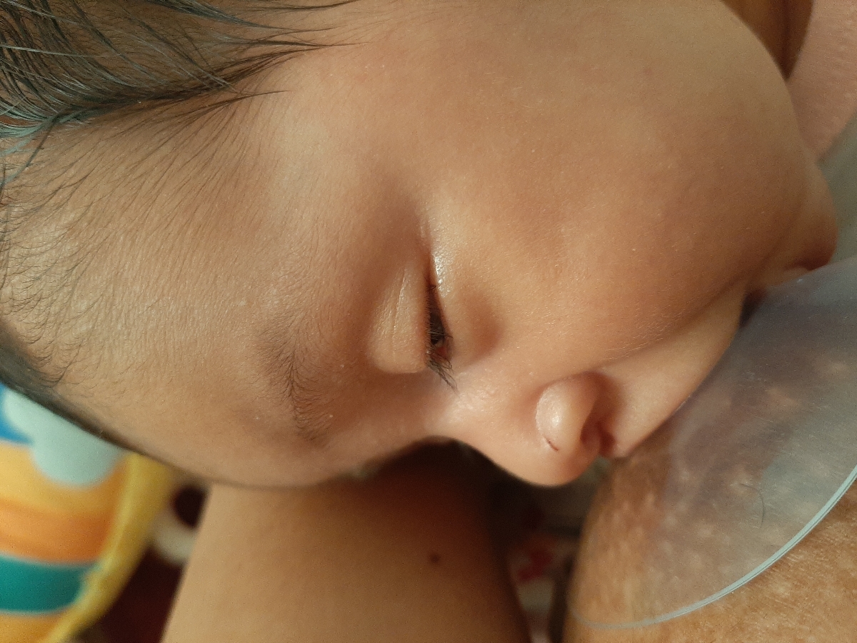 زردی بچه شیرخشک شیر مادر زردی بچه شیرخشک شیر مادر