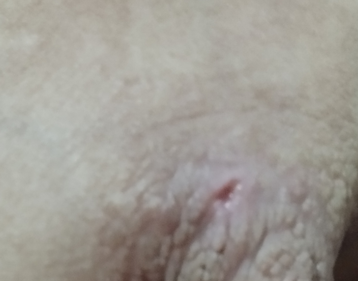 پزشک عزیز میشه این عکسو ببینید و نظرتون بگین ؟؟