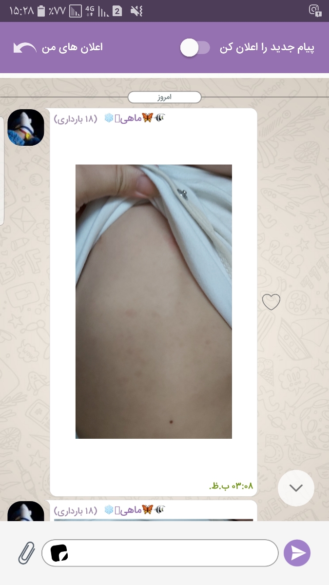 اینم عکس از بدن کوچولوشون دکتر جانم اینم عکس از بدن کوچولوشون دکتر جانم