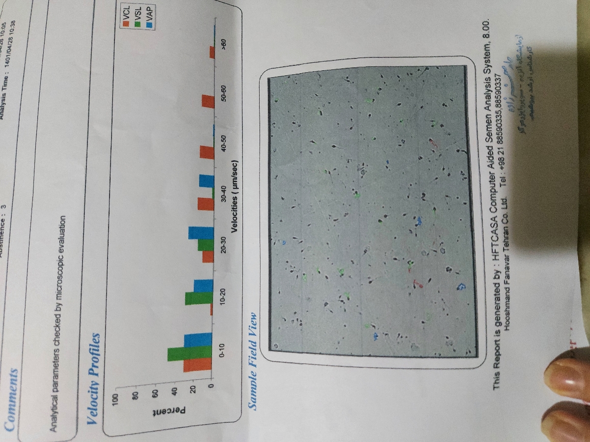 تفسیر آزمایش اسپرم برای اقدام به بارداری