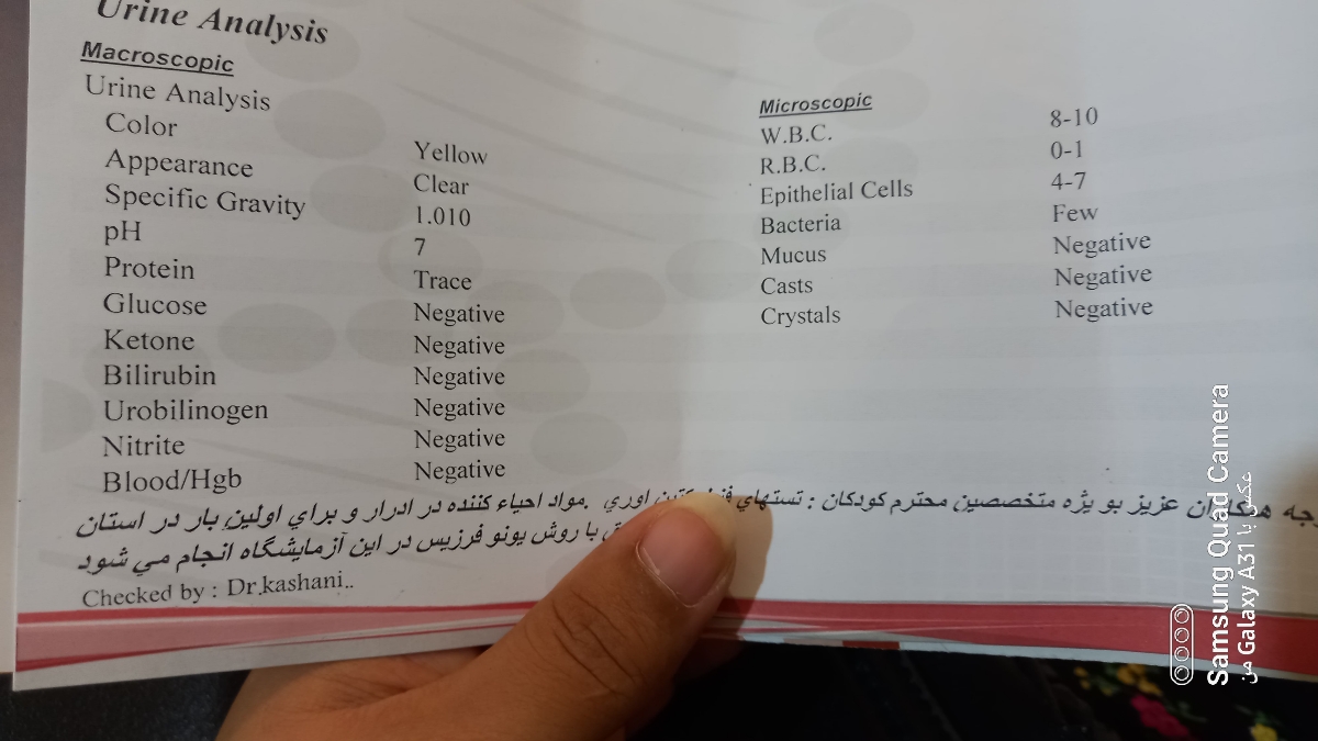 سلام ازمایش پروتئین ادرار