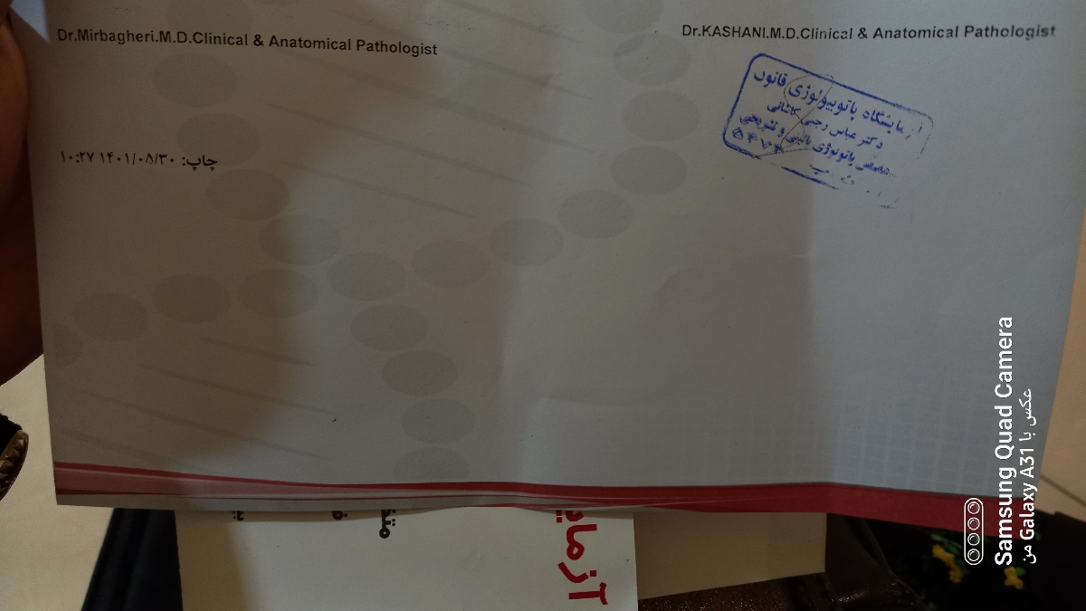 سلام ازمایش پروتئین ادرار