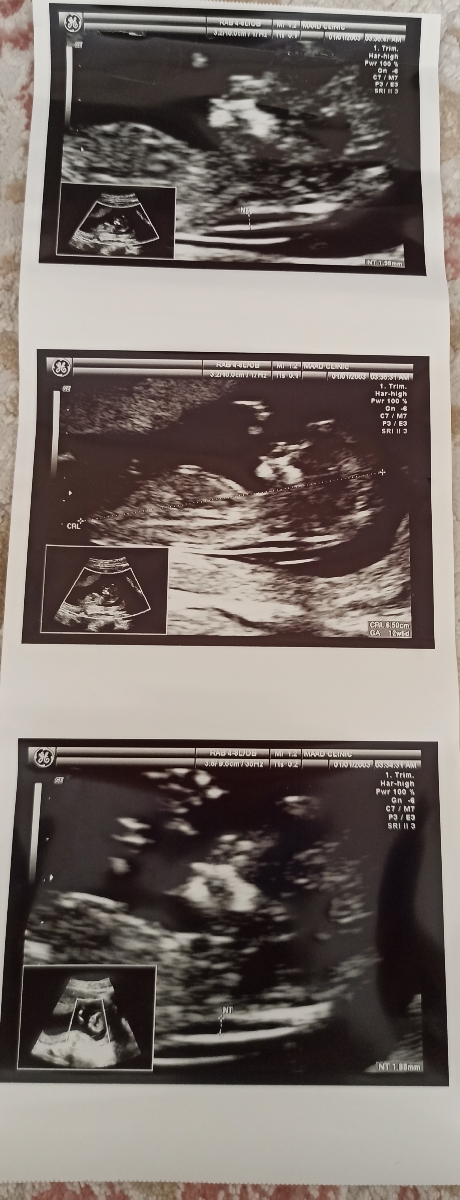 جنسیت nt از روی عکس