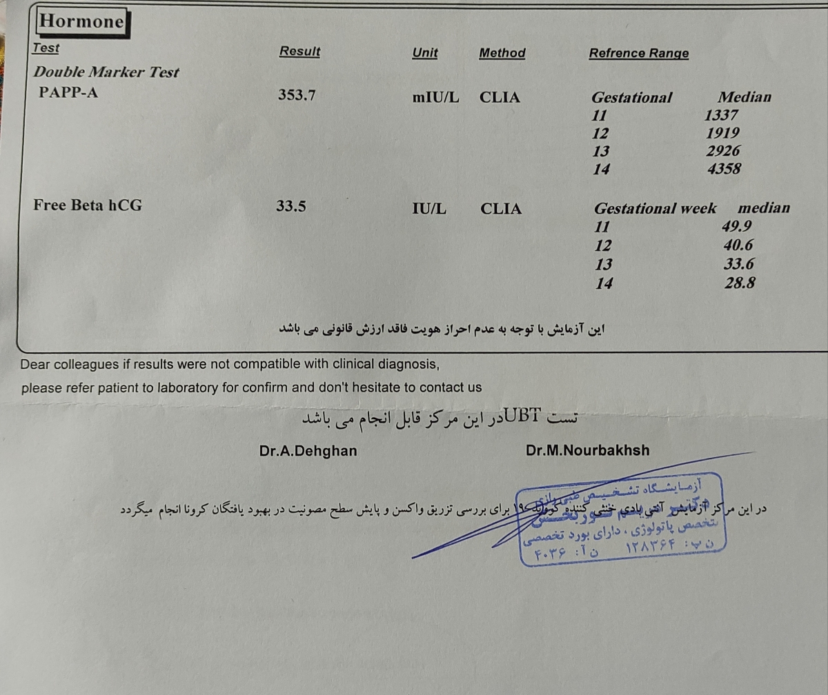 تفسیر سونو ان تی