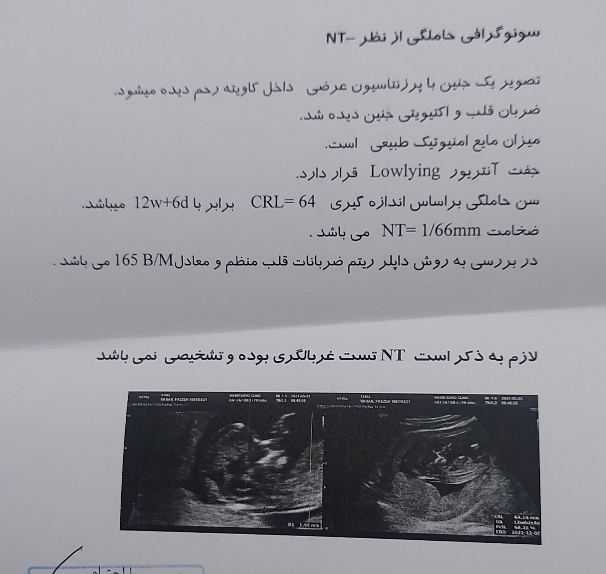 سونوگرافی ان تی هفته ۱۲