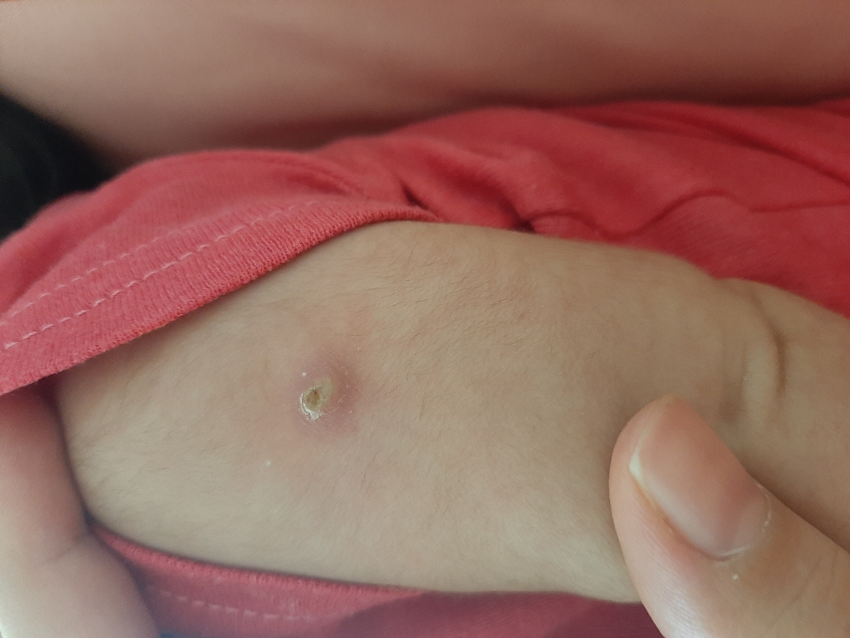 تب ۳۶.۵ در نوزاد چهل روزه