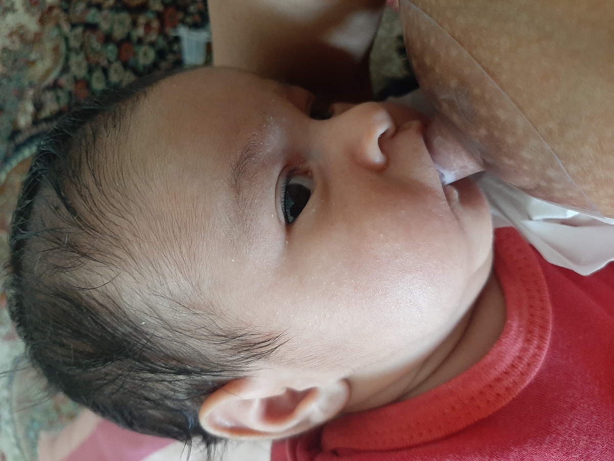 تب ۳۶.۵ در نوزاد چهل روزه