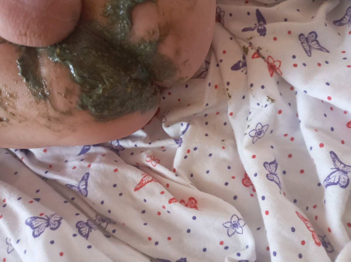 مدفوع سبز نوزاد به همراه عکس