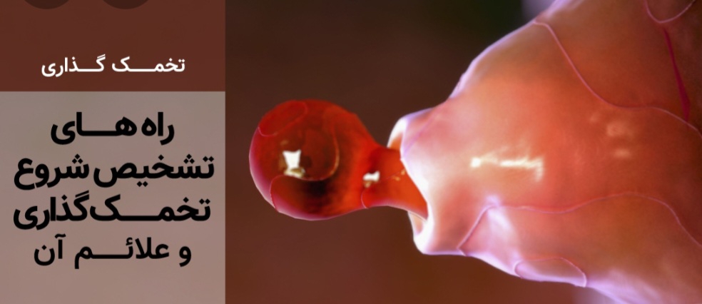مثل این تخمکه رنگش و شکلش مثل این تخمکه رنگش و شکلش