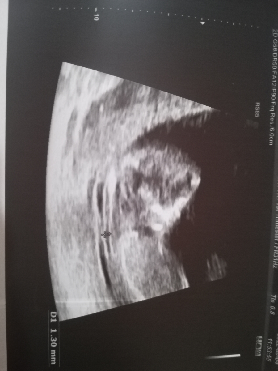 متخصصین تعیین جنسیت تشریف بیارید