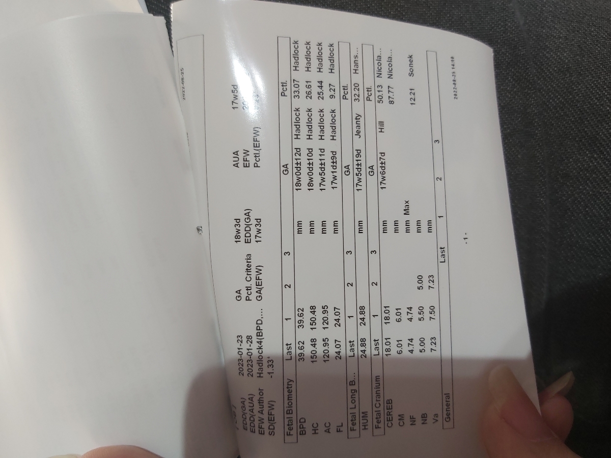 تفسیر سونو آنومالی تفسیر سونو آنومالی