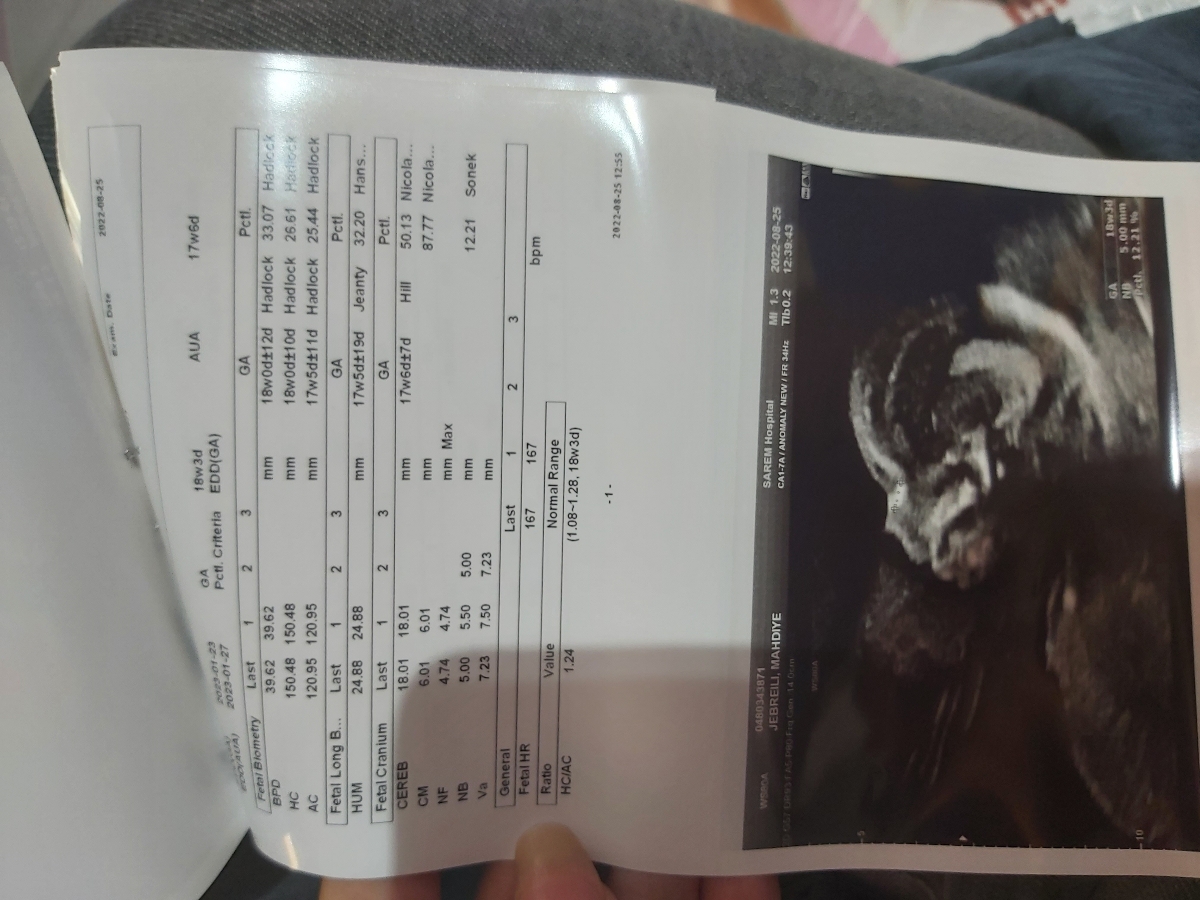 تفسیر سونو آنومالی تفسیر سونو آنومالی