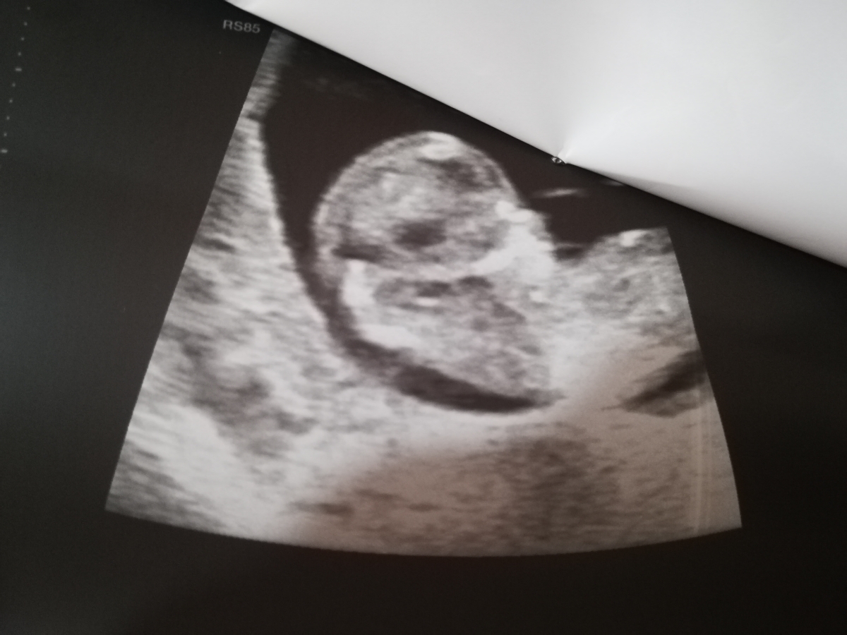 متخصصین تعیین جنسیت تشریف بیارید