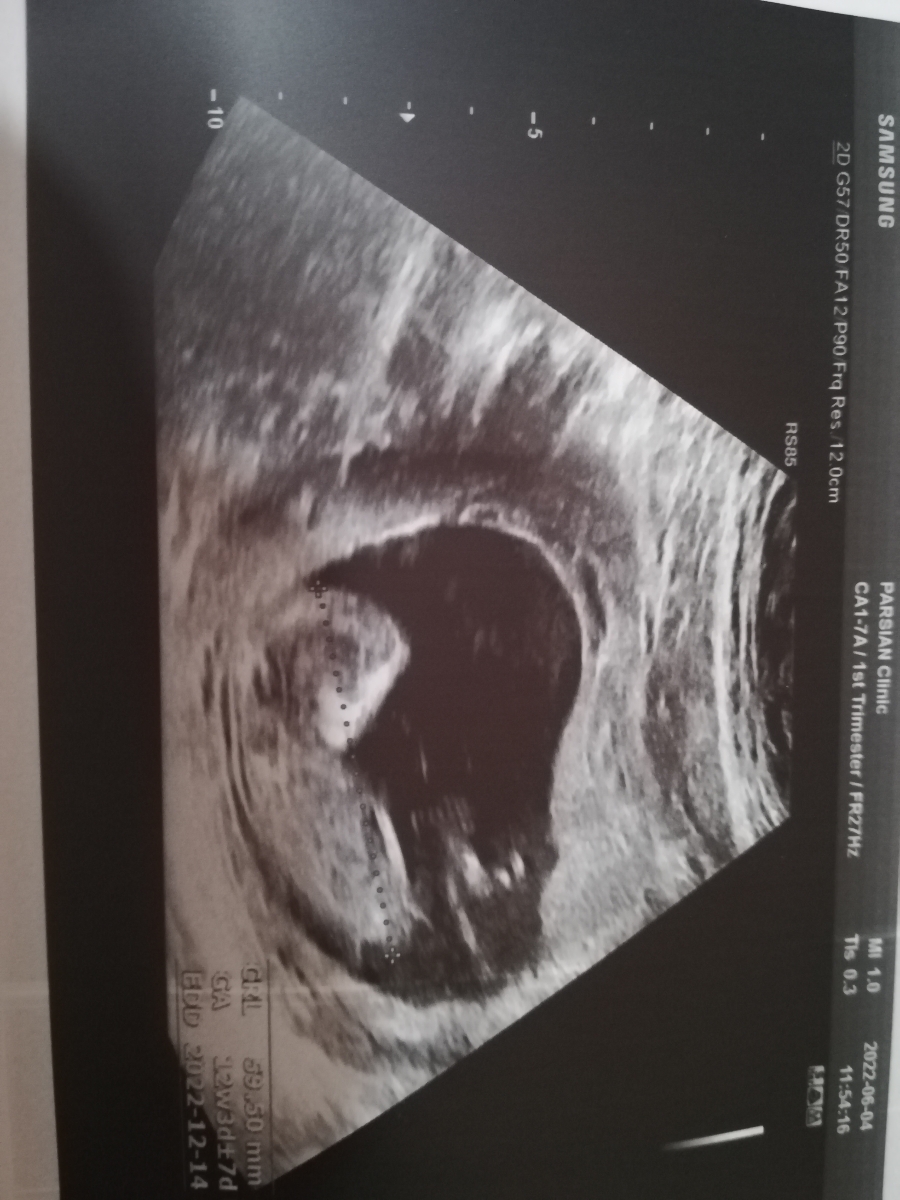 متخصصین تعیین جنسیت تشریف بیارید