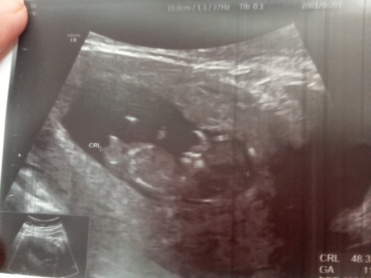 متخصصین تعیین جنسیت تشریف بیارید