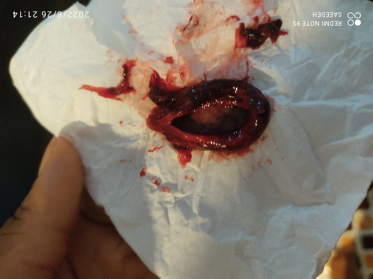 این دفع شد ازم این دفع شد ازم