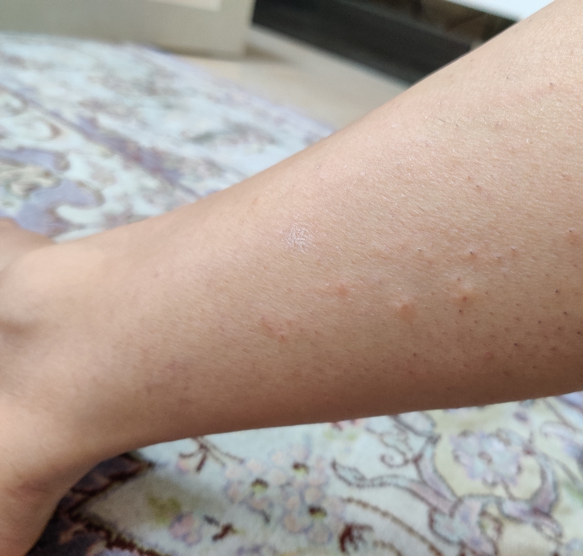 مصرف قرص هیدروکسی کلرکین سولفات و عوارض آن