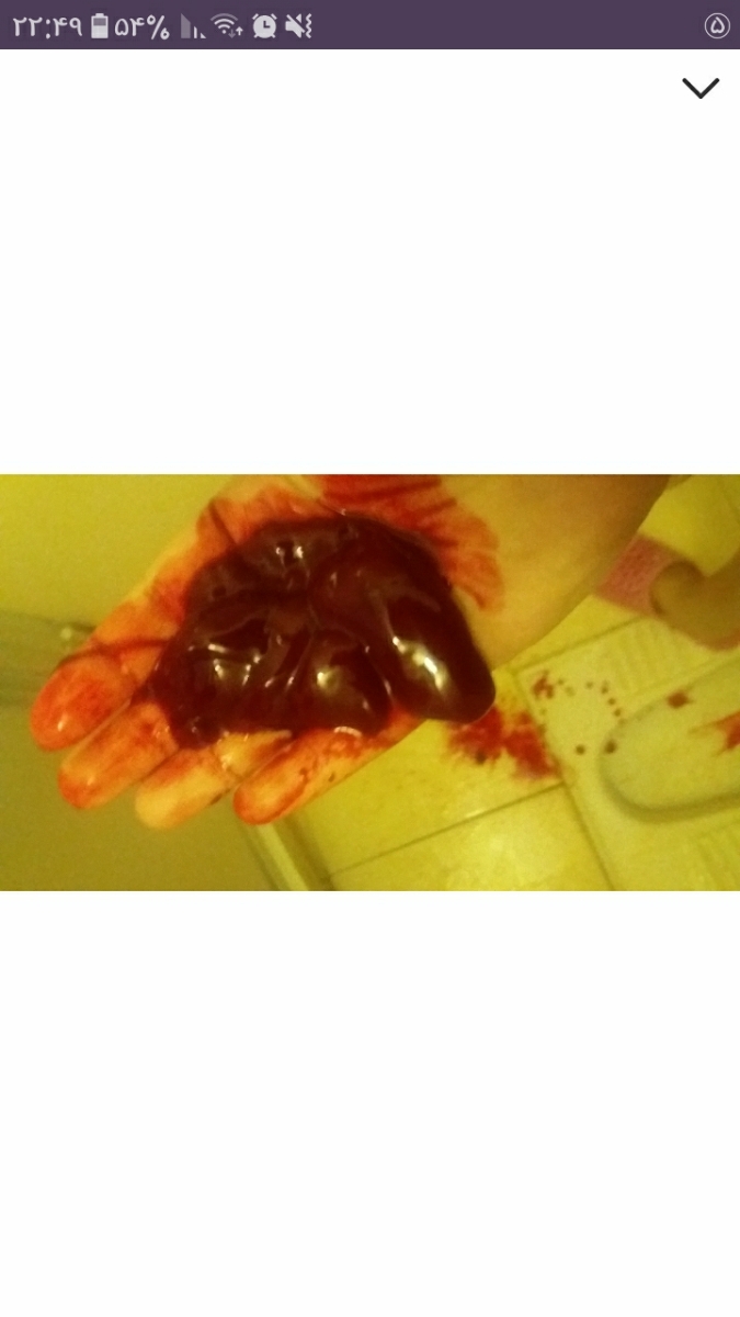 عزیزم لخته های من این اندازه بودن عزیزم لخته های من این اندازه بودن