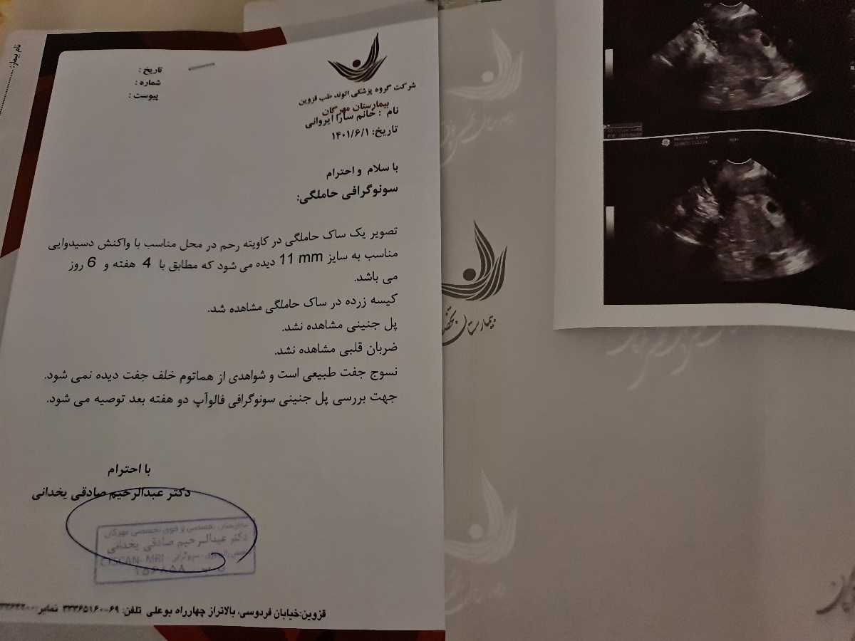دیدن جنین در ساک بارداری