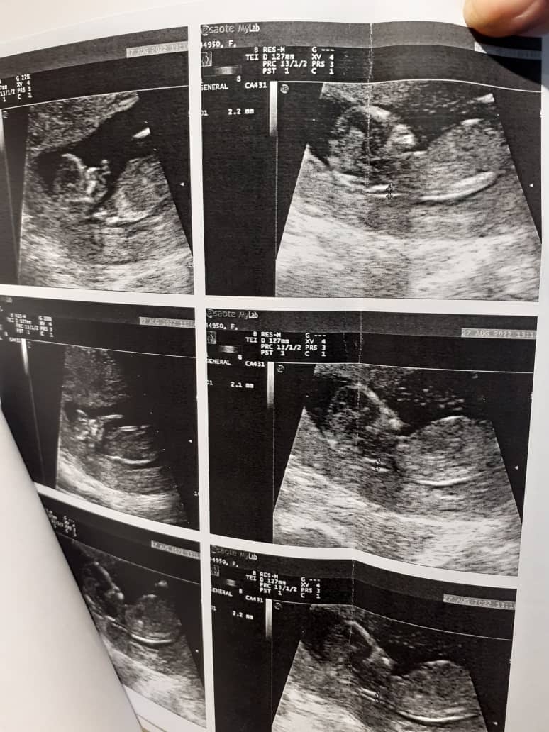 خانم دکتر عزیز بی‌زحمت تفسیر سونو تشکر