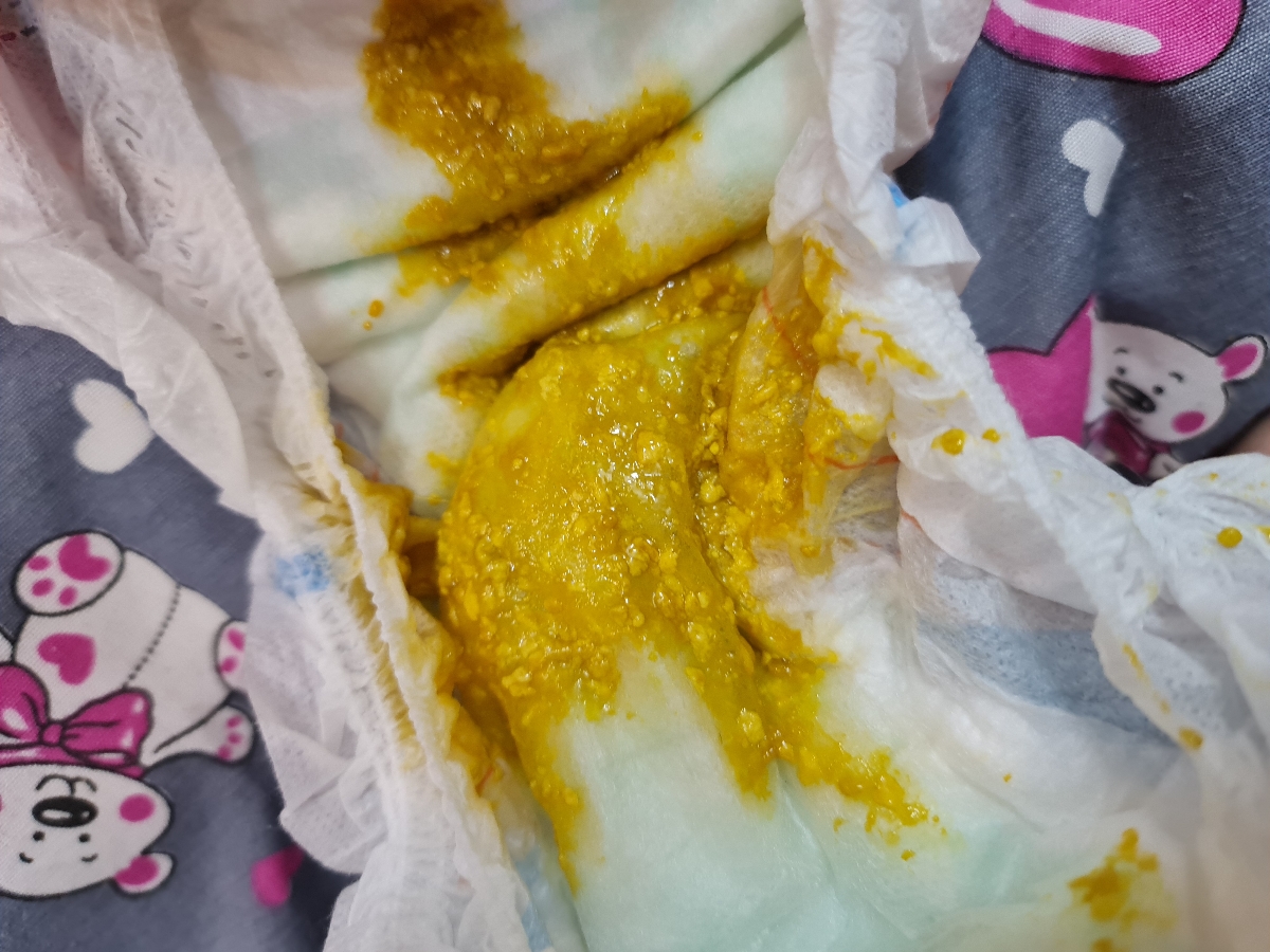 مدفوع نوزاد سه ماهه