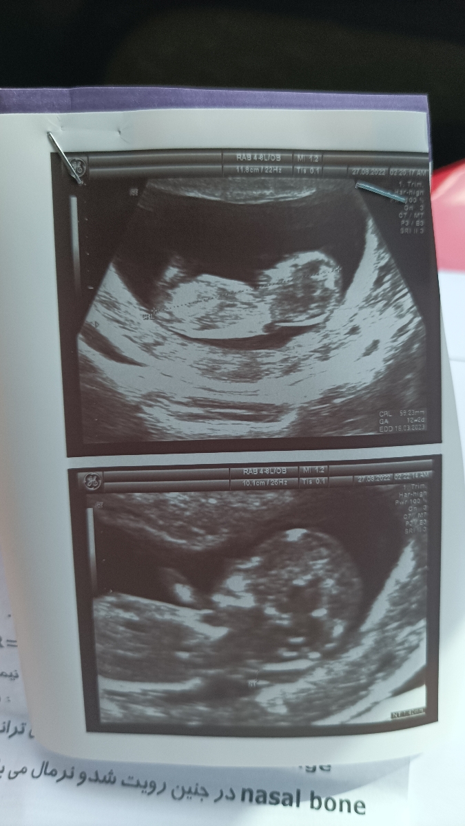 جنسیتو ایانشون میده جنسیتو ایانشون میده