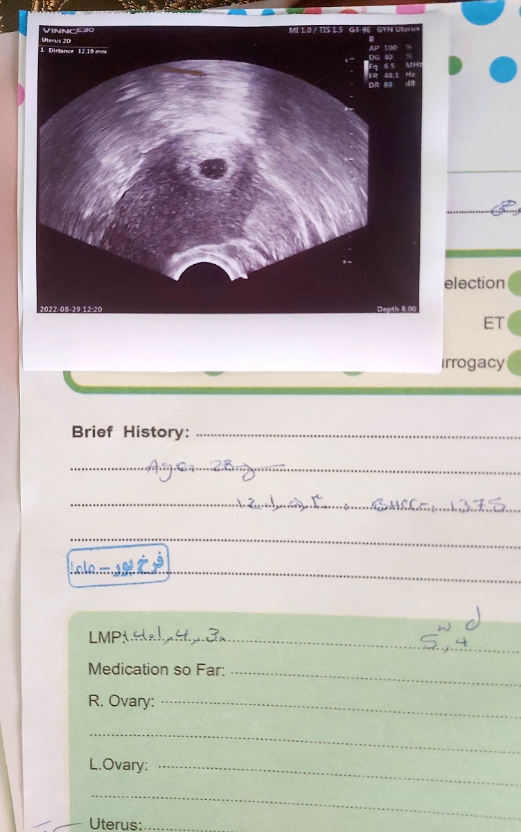 دل درد و کمر درد در بارداری دل درد و کمر درد در بارداری