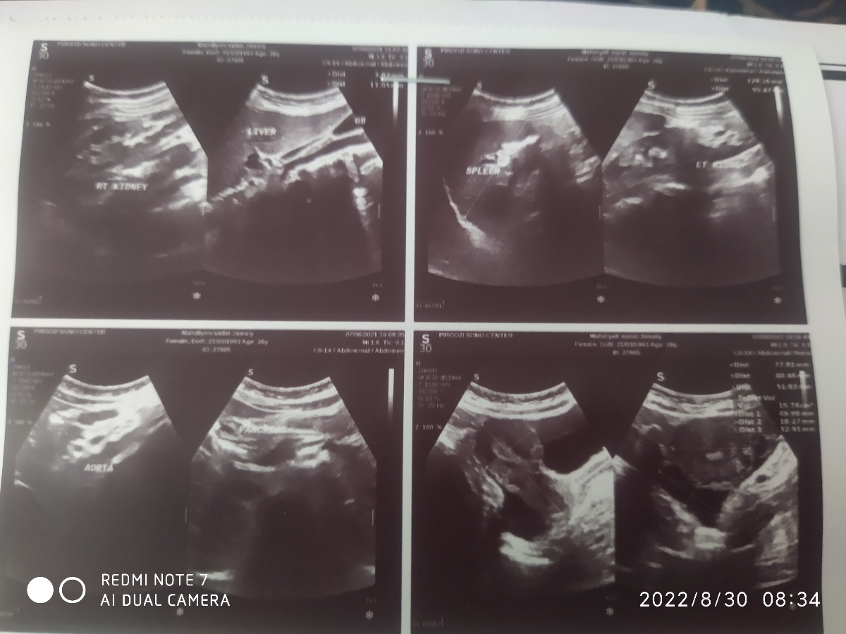 علائم بارداری ولی آزمایش منفی علائم بارداری ولی آزمایش منفی