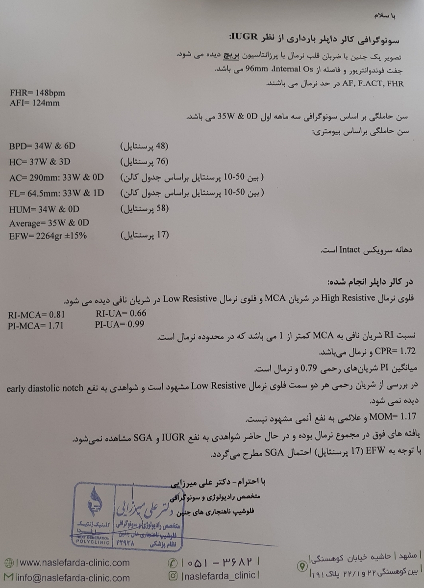 احتما sGA یعنی چی ؟؟