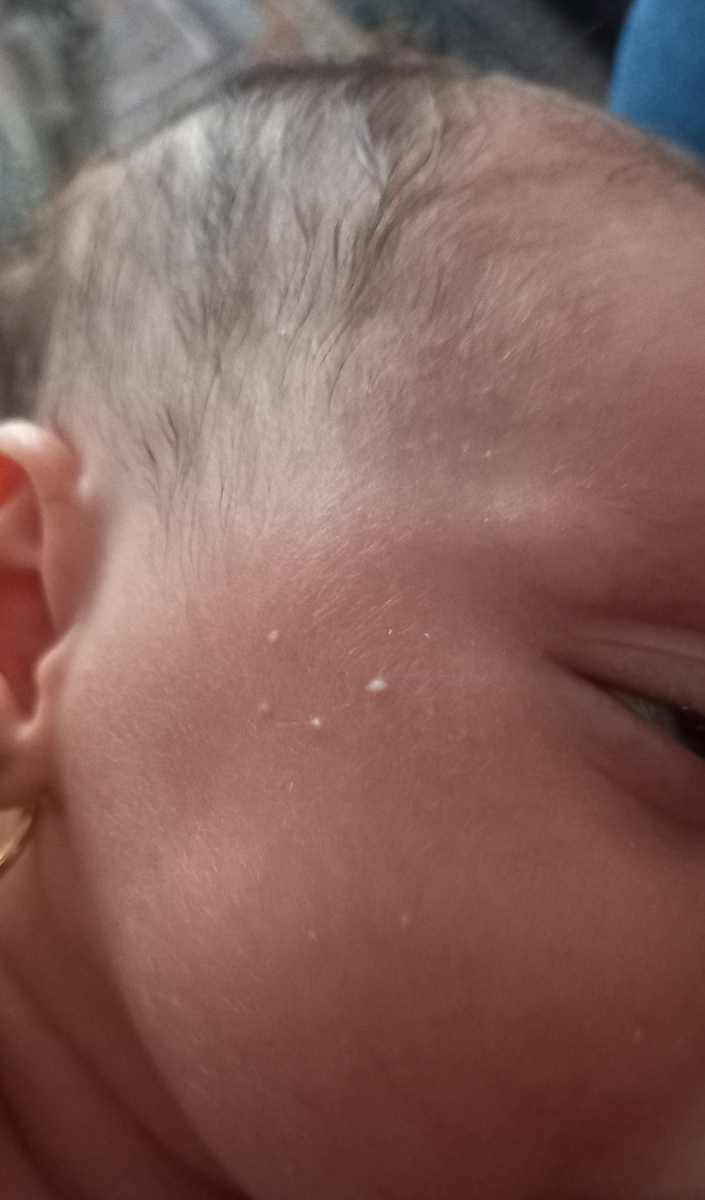 این عکس نقطه های سفید رو پوستشه