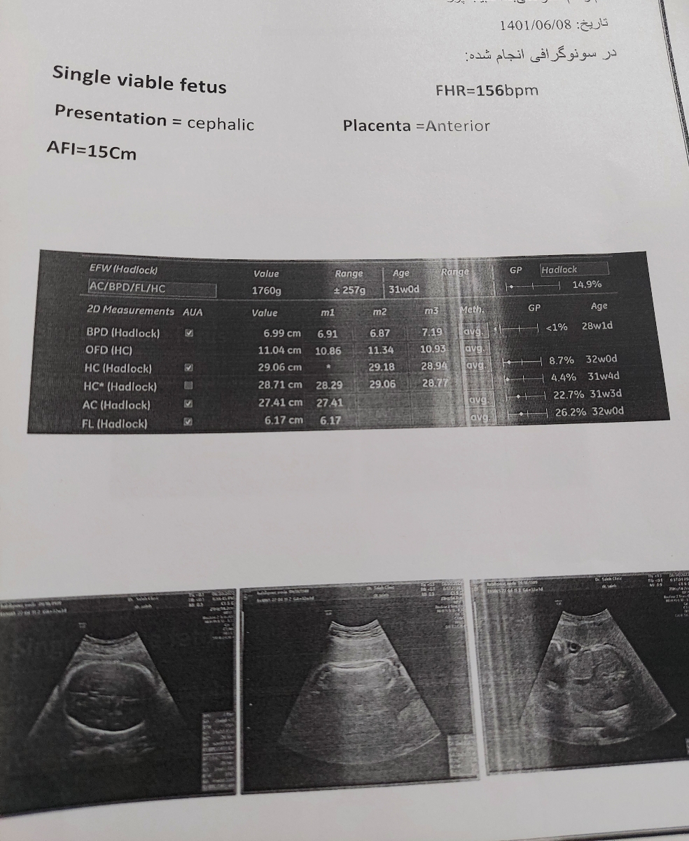 تفسیر سونوگرافی جنین ۳۲هفته