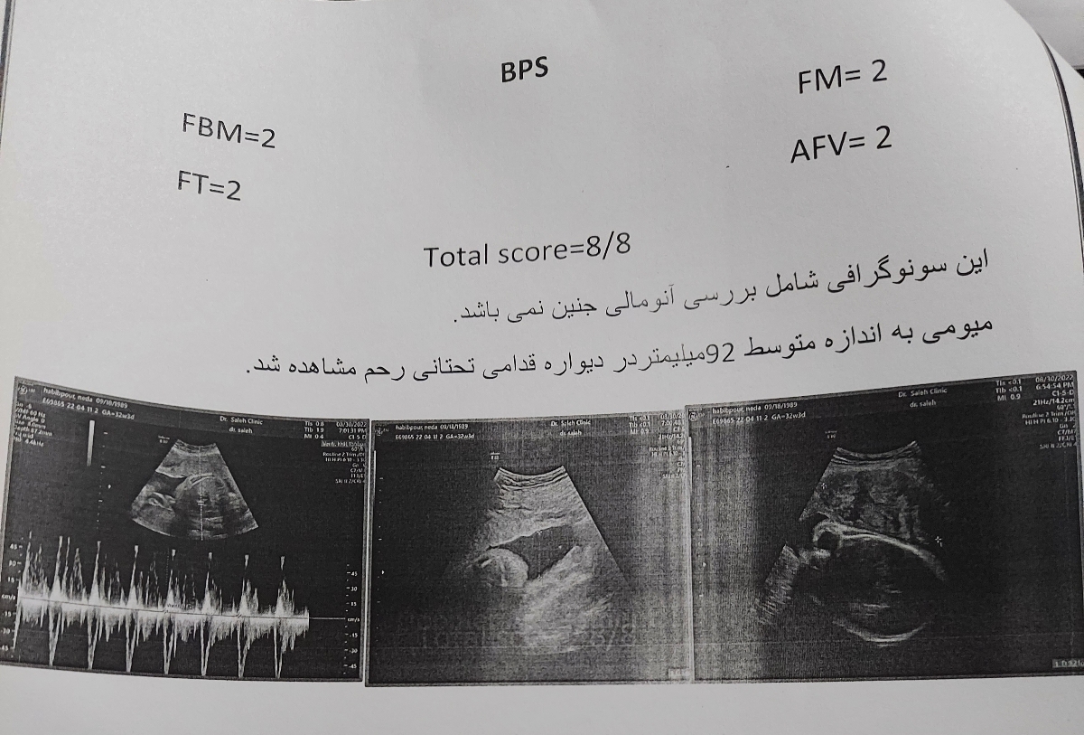 تفسیر سونوگرافی جنین ۳۲هفته