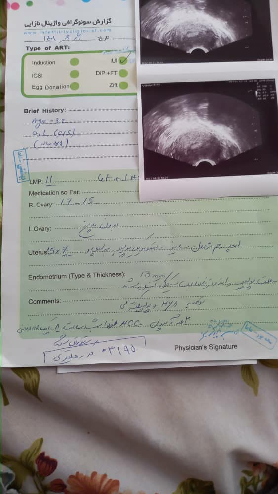 سونو قبل از iui