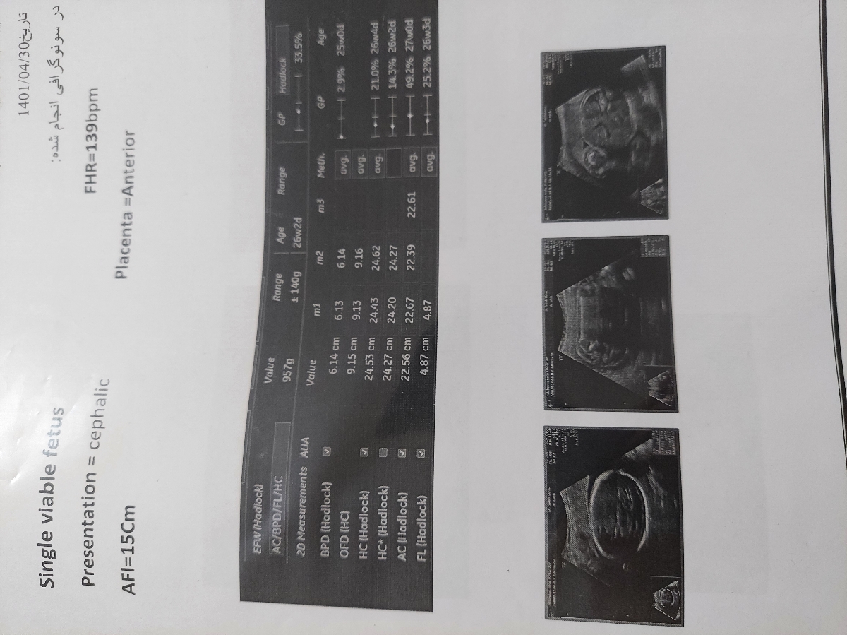 تفسیر سونوگرافی جنین ۳۲هفته