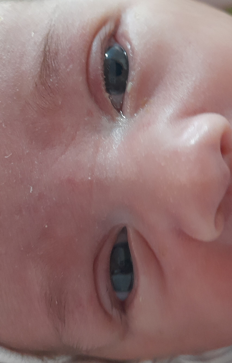 سیر نشدن نوزاد و شیردهی