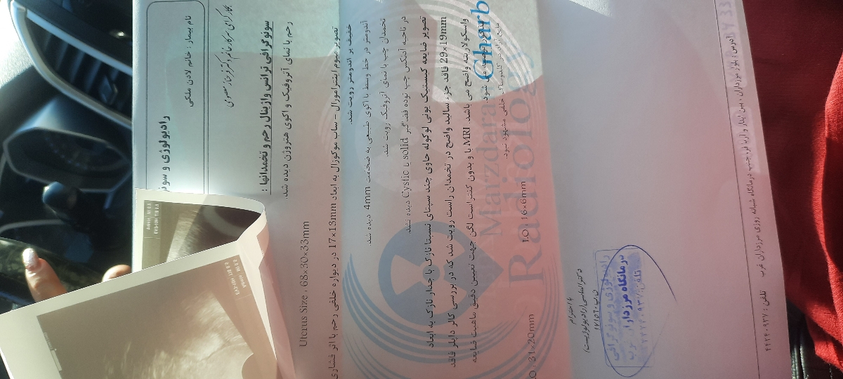 کیست در یائسگی سرطان حساب میشه؟