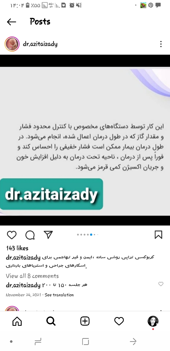 کربوکسی تراپی نقطه جی برای افزایش میل جنسی