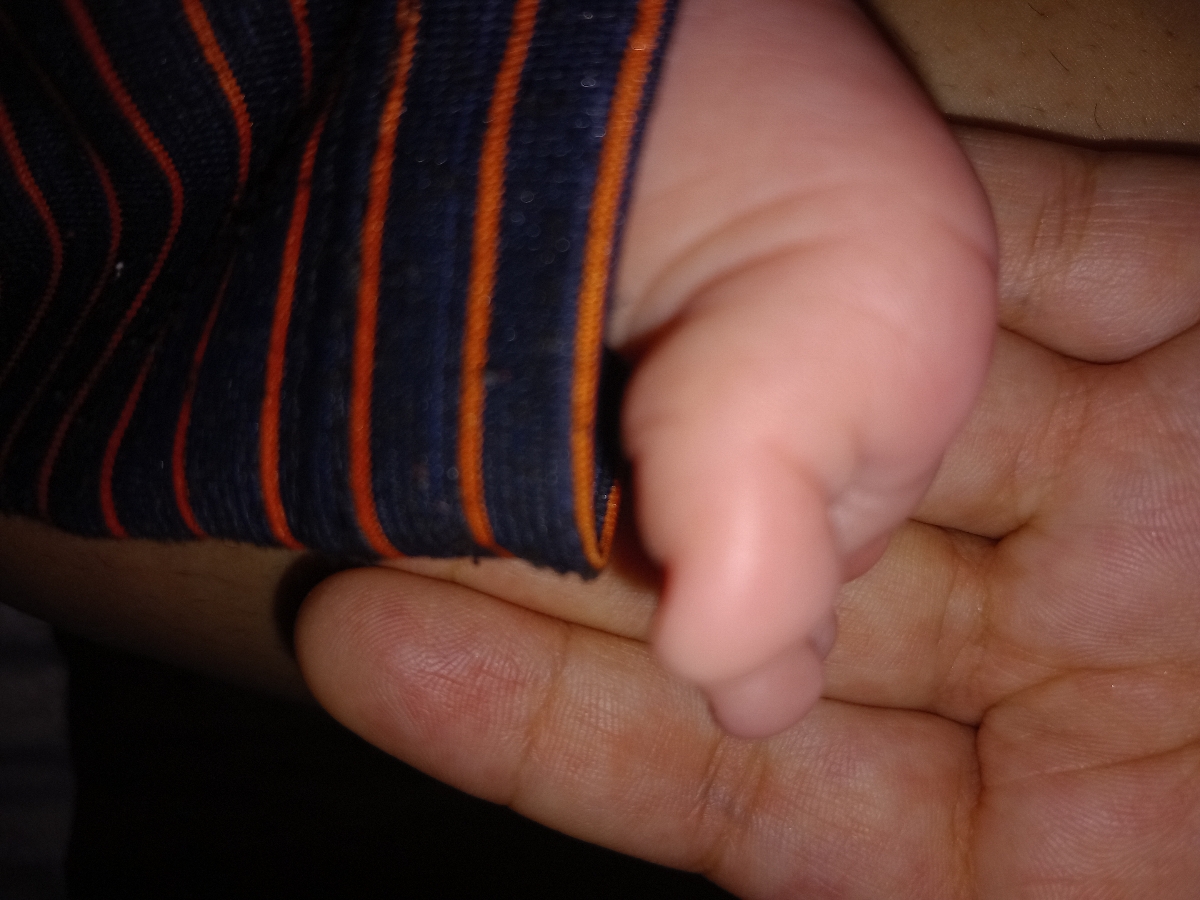 سفتی بدن نوزاد سیزده روزه