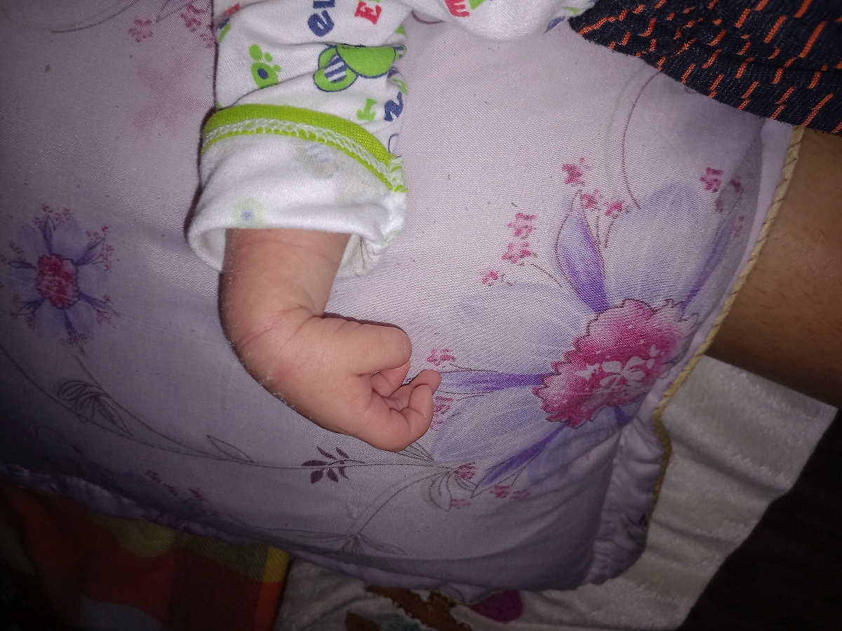 سفتی بدن نوزاد سیزده روزه